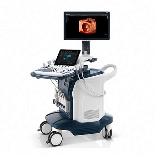 SonoScape S60 SonoScape S60