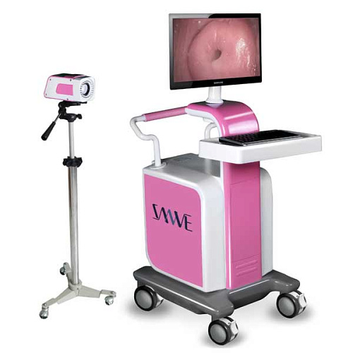 Цифровой видео кольпоскоп SW-3303 Цифровой видео кольпоскоп SW-3303