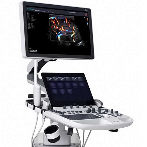 SonoScape P40 Elite SonoScape P40 Elite